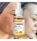 New Turmeric Freckle Serum Whitening Dark Spots Organic Oils Brighten Dark Skin Pigment Anti Aging Wrinkle Moisturizer 10ml